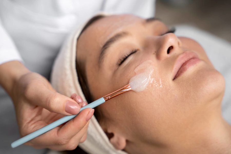 Kimyasal Peeling Nedir? TCA Kimyasal Peeling ile Akne İzi Tedavisi